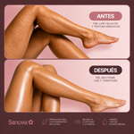 Sanova® Aceite Anticelulítico